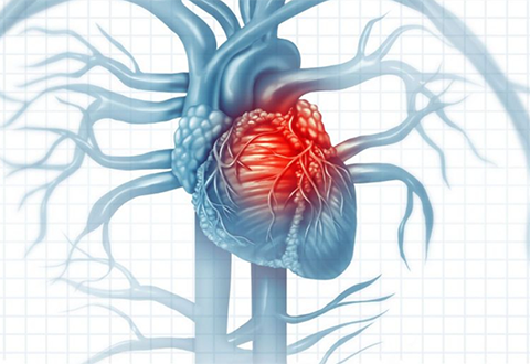ATTR-CM - heart picture