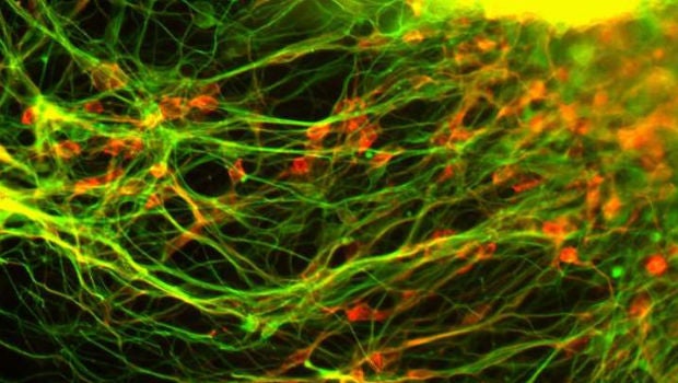 Singapore scientists see way to help Parkinson's patients