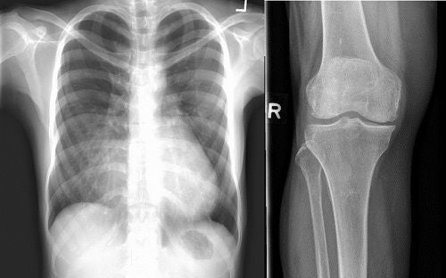 xray-image