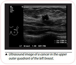 Breast Cancer Diagnosis - Ultrasound