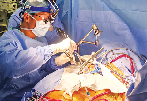 A Double Feat - Minimally Invasive Double Valve Surgery
