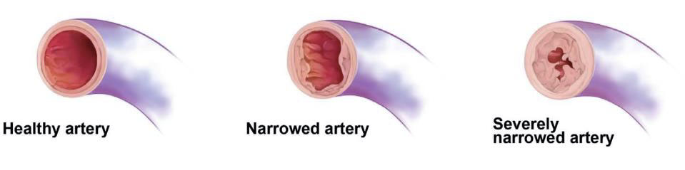 arteries illustration