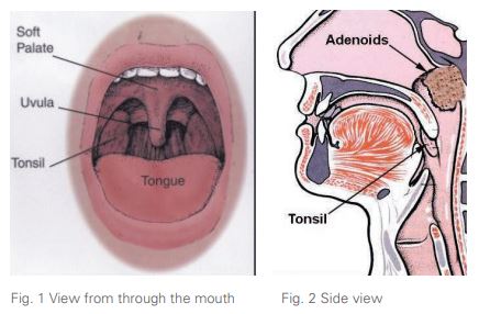 Tonsils and Adenoids