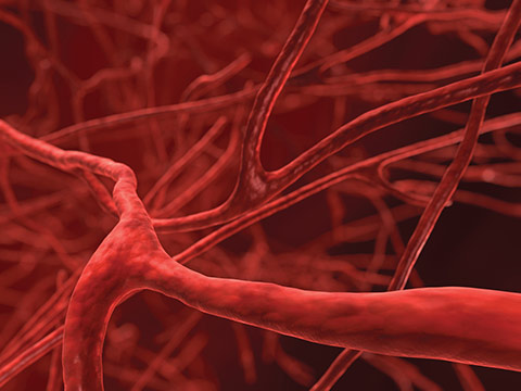 Arteriovenous Malformation(AVM) Condition and Treatments