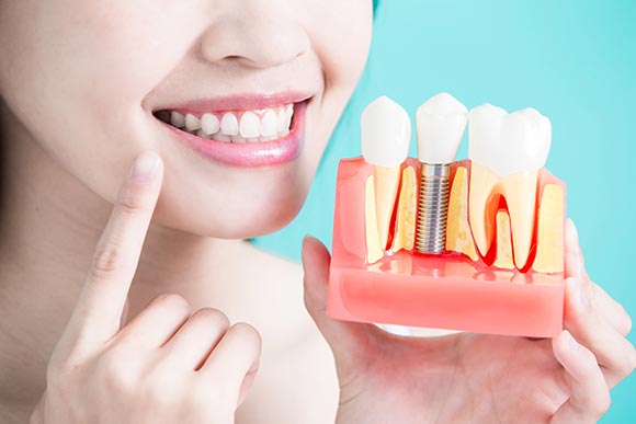 dental implants conditions and treatments