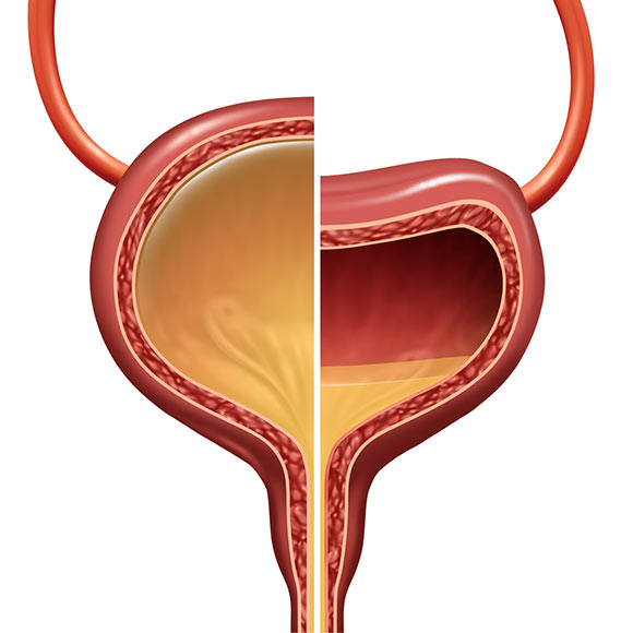 overactive bladder conditions and treatments