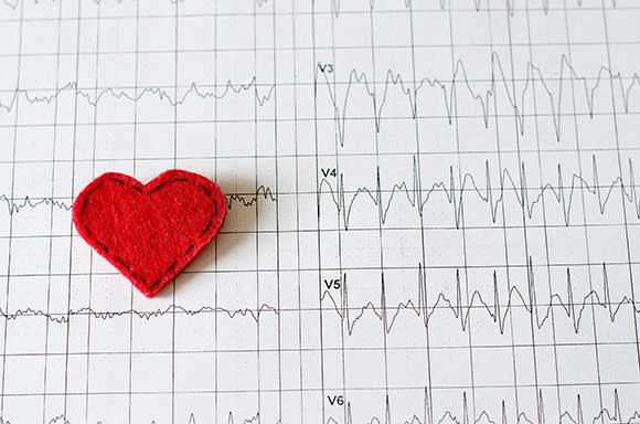 ​Tachycardia conditions and treatments
