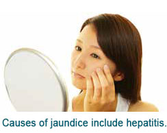 jaundice conditions & treatments