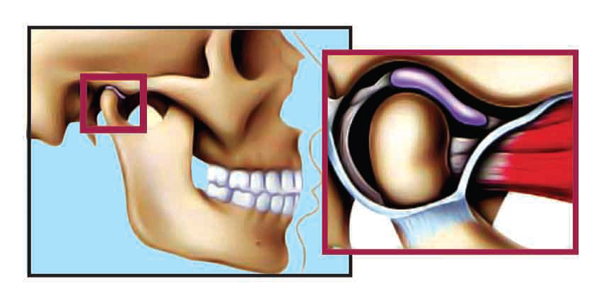 Temporomandibular Joint in Normal Closed Position
