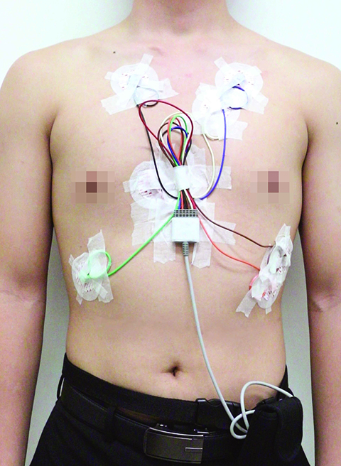 ECG Holter Monitor System