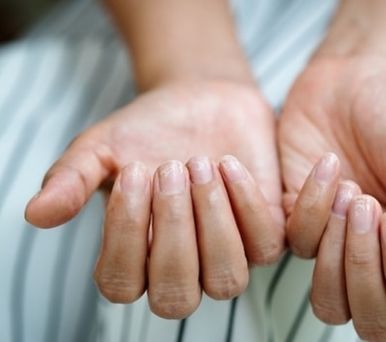 Common Hand Infections: Management in Primary Care