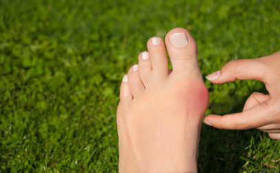 Improving Outcomes with Minimally Invasive Bunion Surgery