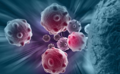 A New Strategy to Treat Metastatic Intra-Abdominal Cancer