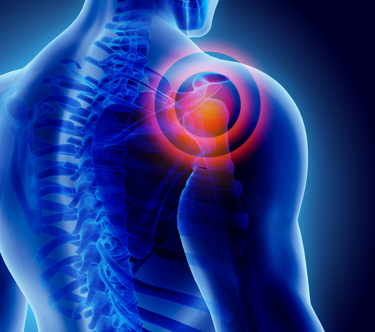 How to Manage Common Shoulder Conditions