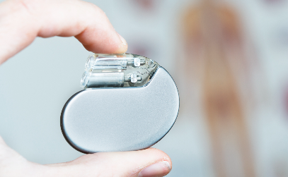 Implantable Cardioverter Defibrillator: Procedure & How It Works 