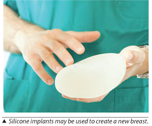 Silicone implants may be used to create a new breast
